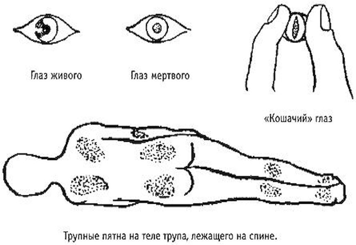 Что может повлиять на скорость процесса разложения трупа