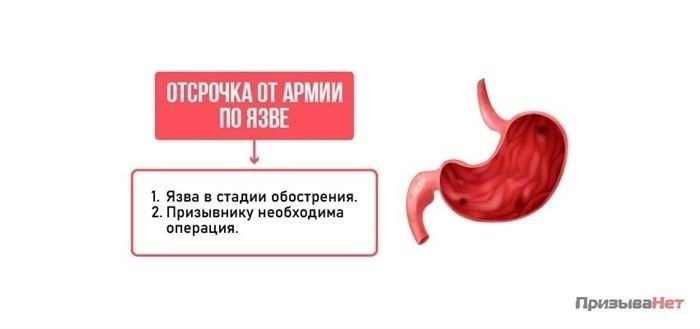 Что говорит Расписание болезней о язвенной болезни?