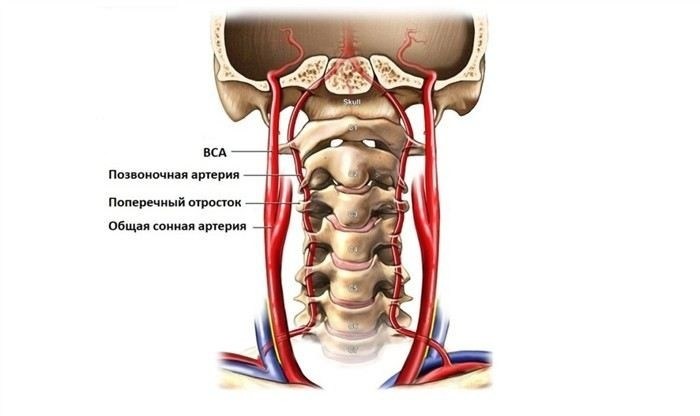 Гипоплазия позвоночной артерии: причины, симптомы и лечение