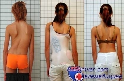 Какие симптомы могут указывать на деформацию грудной клетки?