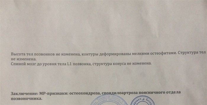 Почему с ишиасом сложно служить в армии: реальные ограничения