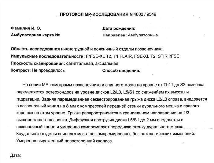 Какие виды радикулопатии рассматриваются в медкомиссии?