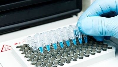 Этапы полимеразной цепной реакции: как проходит ПЦР-тест?