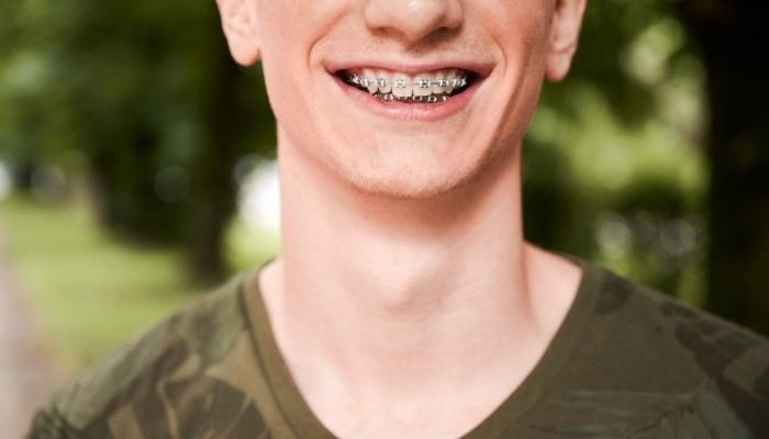 Что делать, если с брекетами забирают в армию?