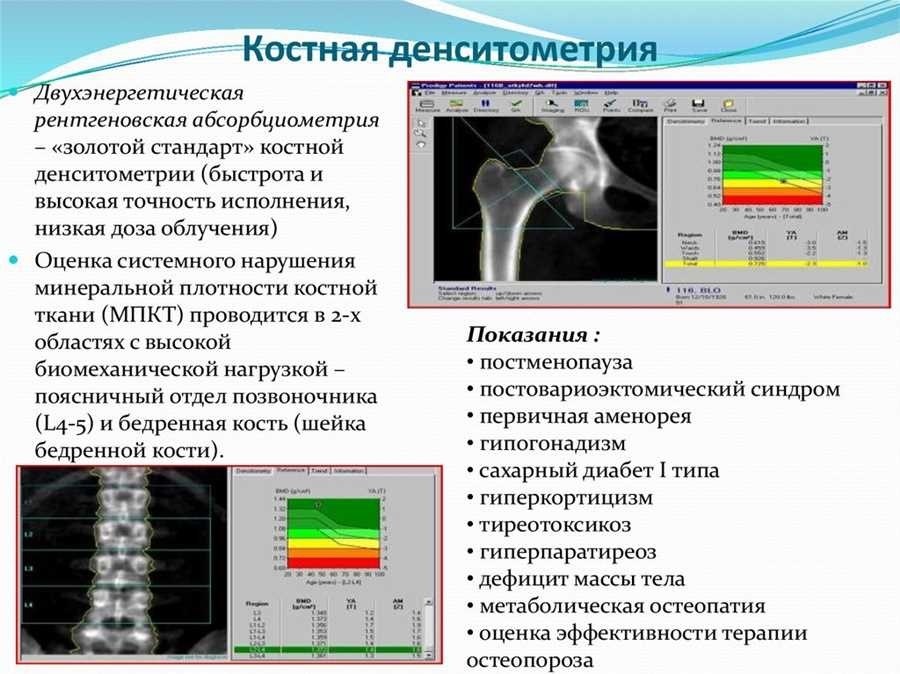 Денситометрия опасно ли для здоровья 