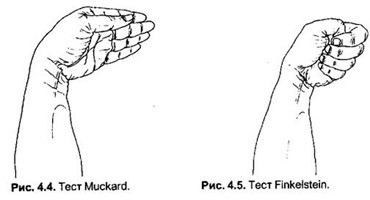 Типичные ошибки при контроле амплитуды в области руки и их влияние на итог