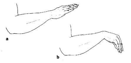Референсные значения угла работы локтя у взрослых