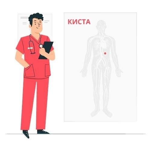 Медицинские показания для освобождения от службы с кистой