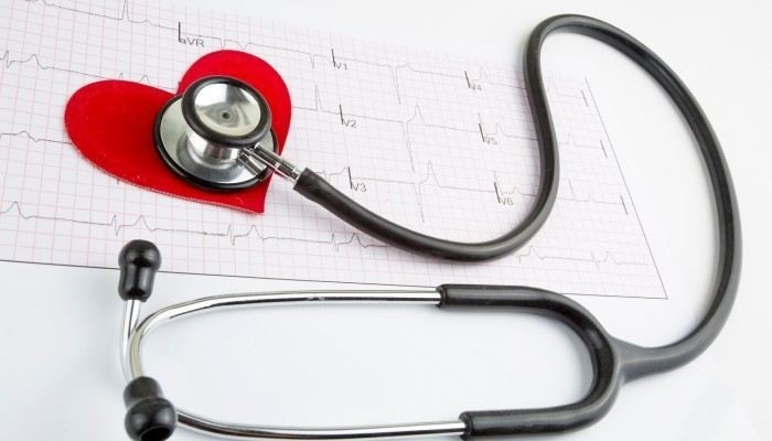 Какие виды аритмии могут стать основанием для освобождения от службы?