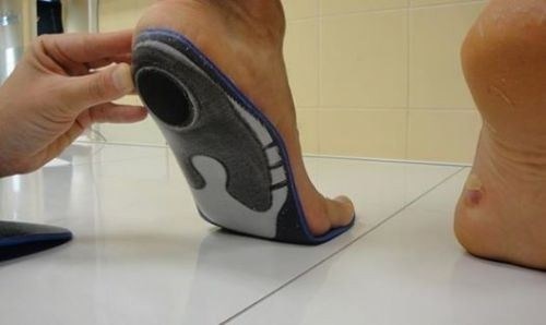 Почему при плоскостопии без нарушения функций чаще всего ставят категорию 