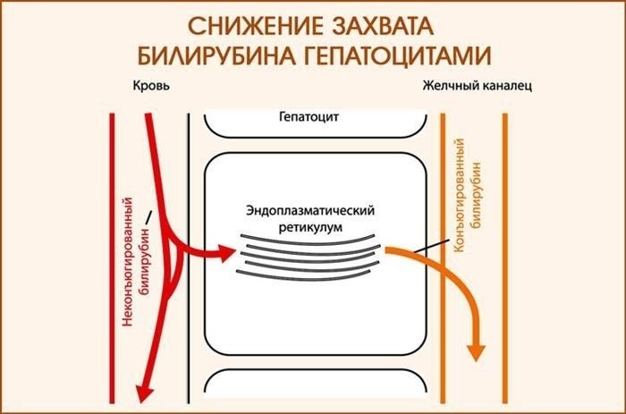 Процесс подачи апелляции в случае признания годным к службе, несмотря на синдром Жильбера